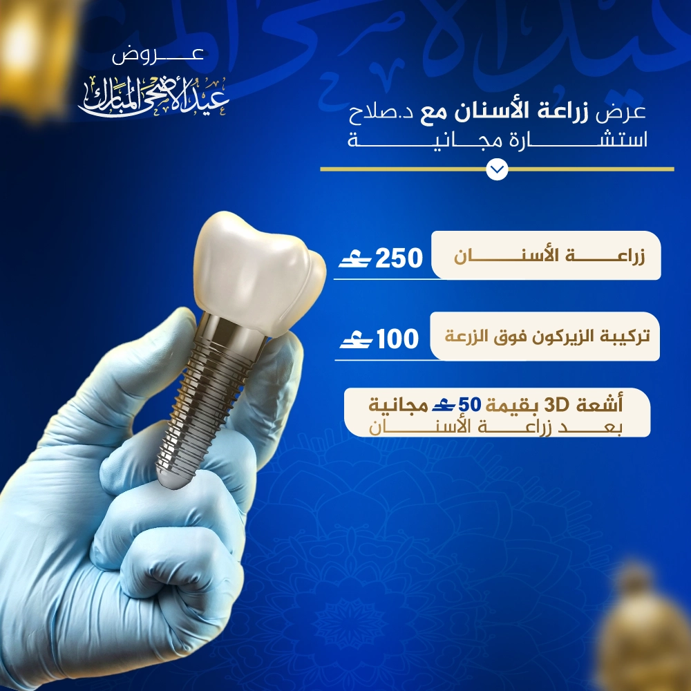 زراعة الأسنان