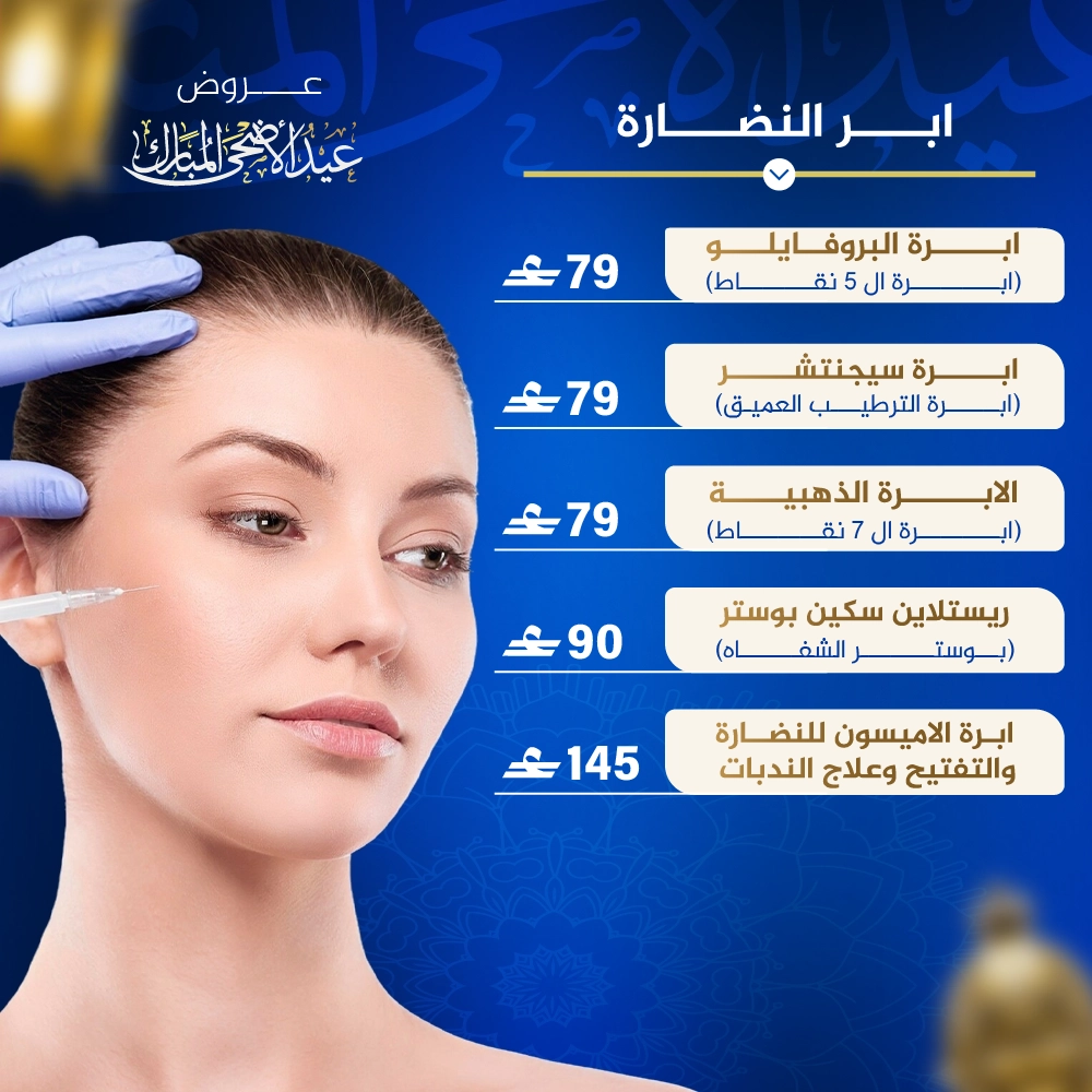 النضارة